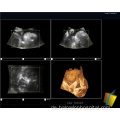 Krankenhaus Mobile Farbe Ultraschallmaschinen Laptop Herz